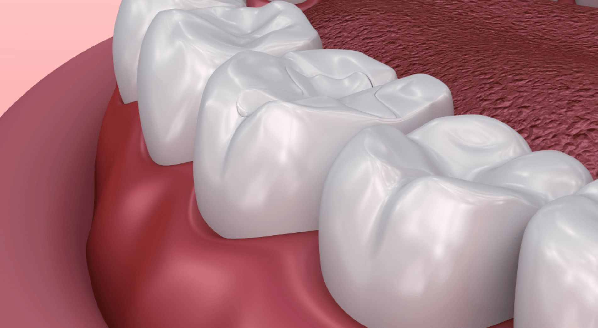 Overview Image - The London Smile Clinic