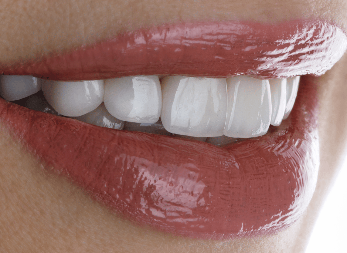 Final Reveal Procedure Image - The London Smile Clinic