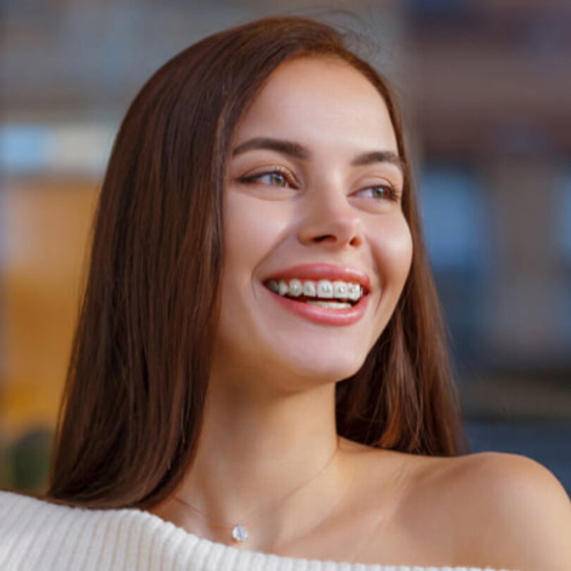 invisalign-traditional-img2 Comparison Traditional Image