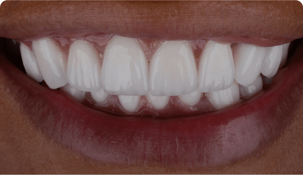 Mask group@3x Case Image