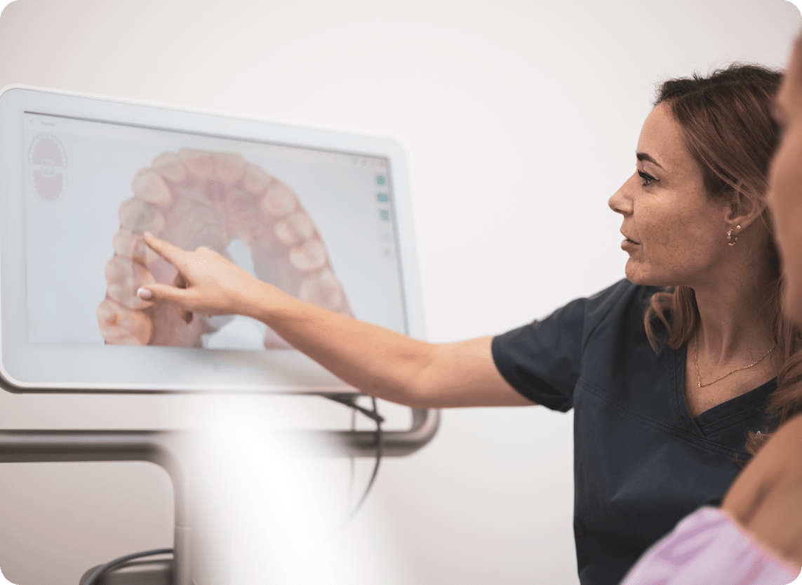 3D Preview Procedure Image - The London Smile Clinic